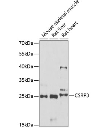 CSRP3 Rabbit Polyclonal Antibody
