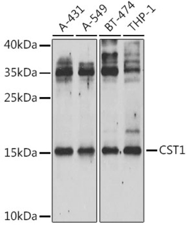 CST1 Rabbit Polyclonal Antibody