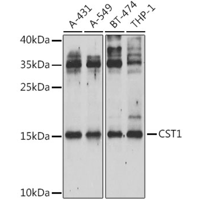 CST1 Rabbit Polyclonal Antibody