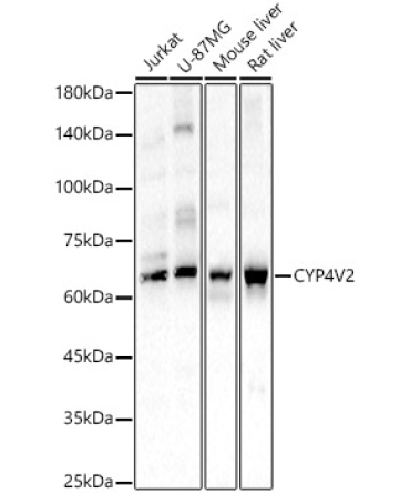 CYP4V2 Rabbit Polyclonal Antibody