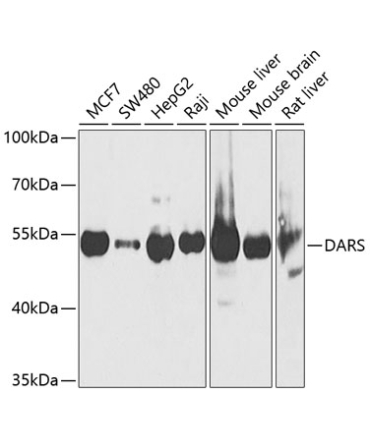 DARS Rabbit Polyclonal Antibody