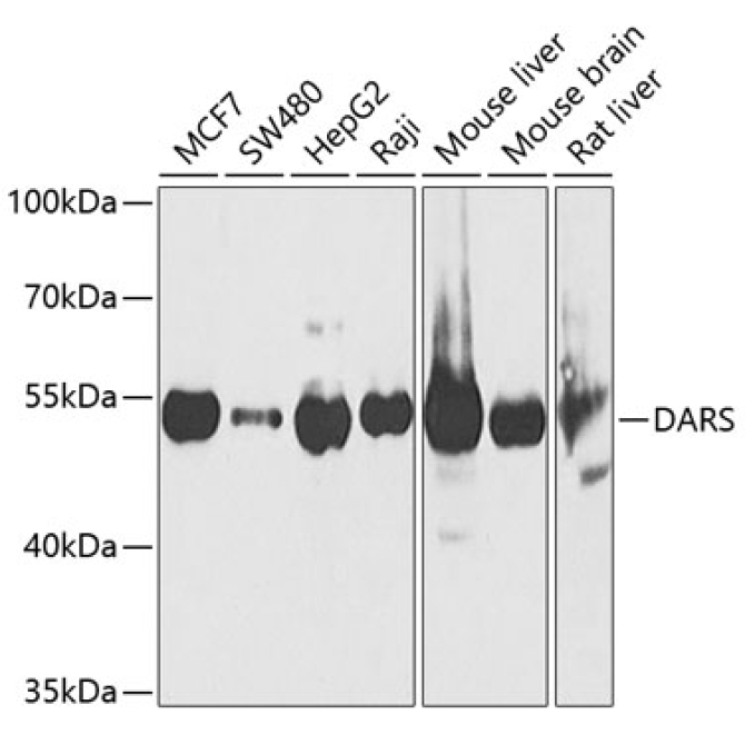 DARS Rabbit Polyclonal Antibody