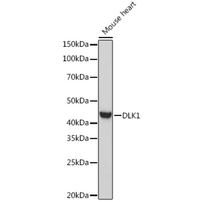 DLK1 Rabbit Polyclonal Antibody