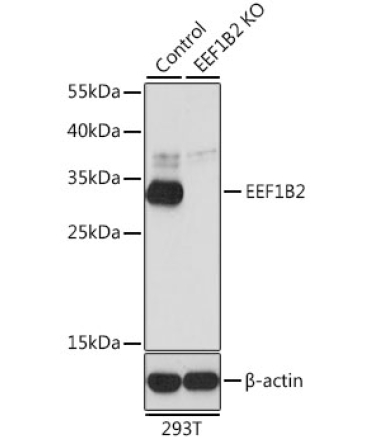 EEF1B2 Rabbit Polyclonal Antibody [KO Validated]