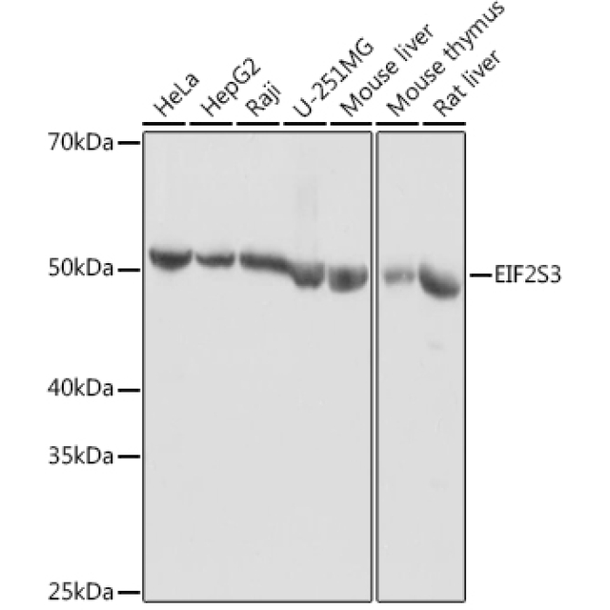 EIF2S3 Rabbit Polyclonal Antibody