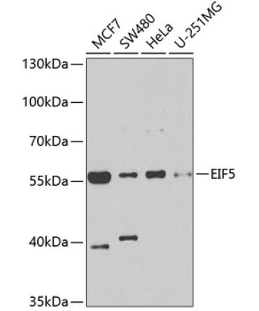 EIF5 Rabbit Polyclonal Antibody