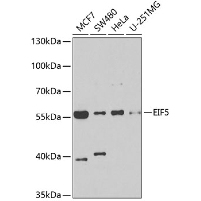 EIF5 Rabbit Polyclonal Antibody