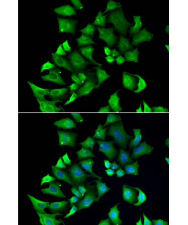 ENTPD2 Rabbit Polyclonal Antibody
