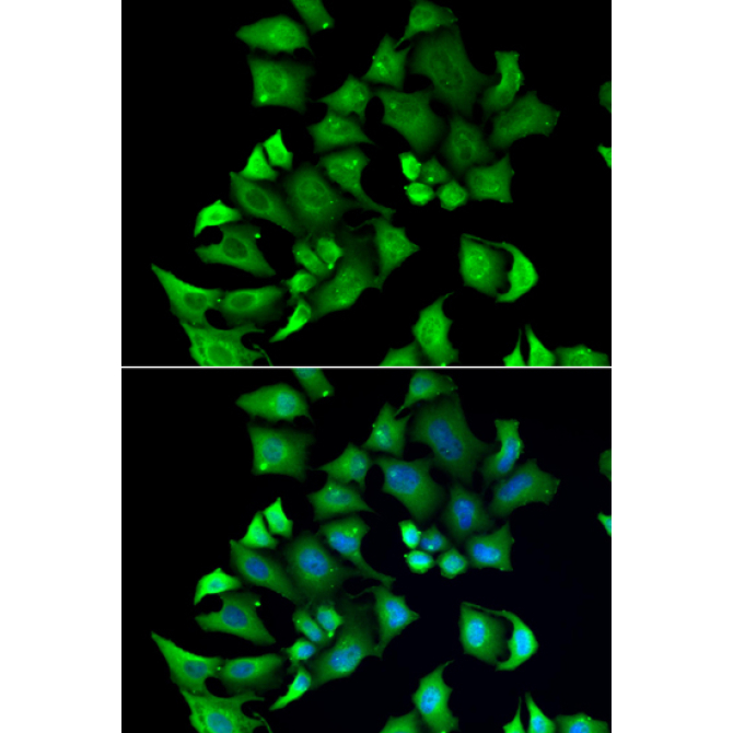 ENTPD2 Rabbit Polyclonal Antibody