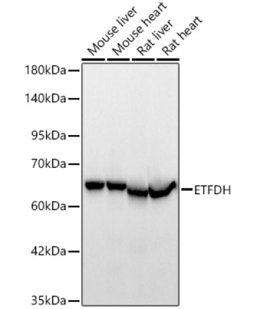 ETFDH Rabbit Polyclonal Antibody
