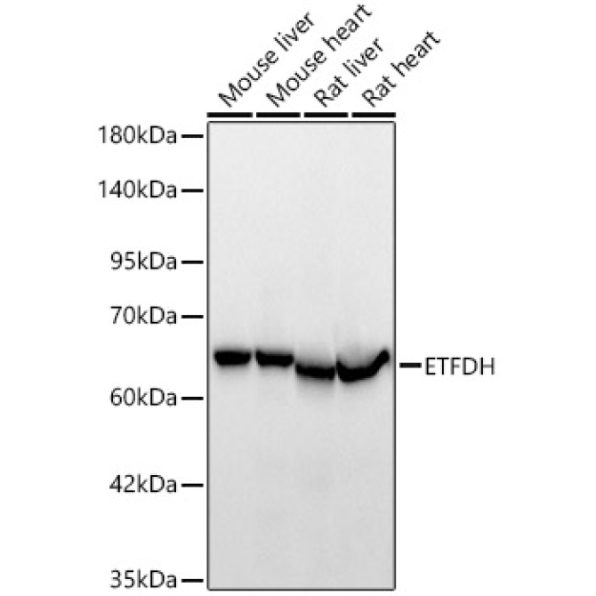 ETFDH Rabbit Polyclonal Antibody