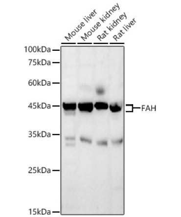 FAH Rabbit Polyclonal Antibody