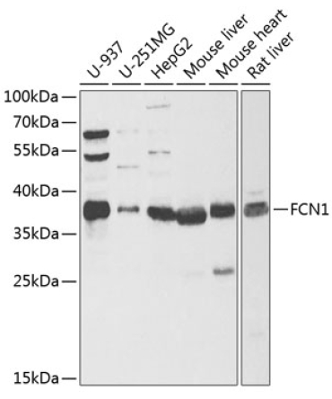 FCN1 Rabbit Polyclonal Antibody