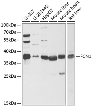 FCN1 Rabbit Polyclonal Antibody