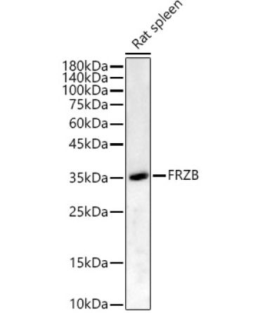 FRZB Rabbit Polyclonal Antibody