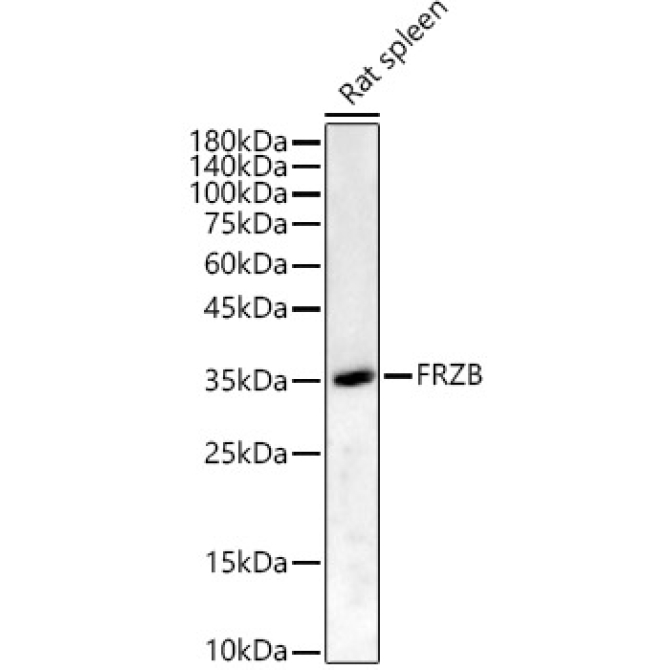 FRZB Rabbit Polyclonal Antibody