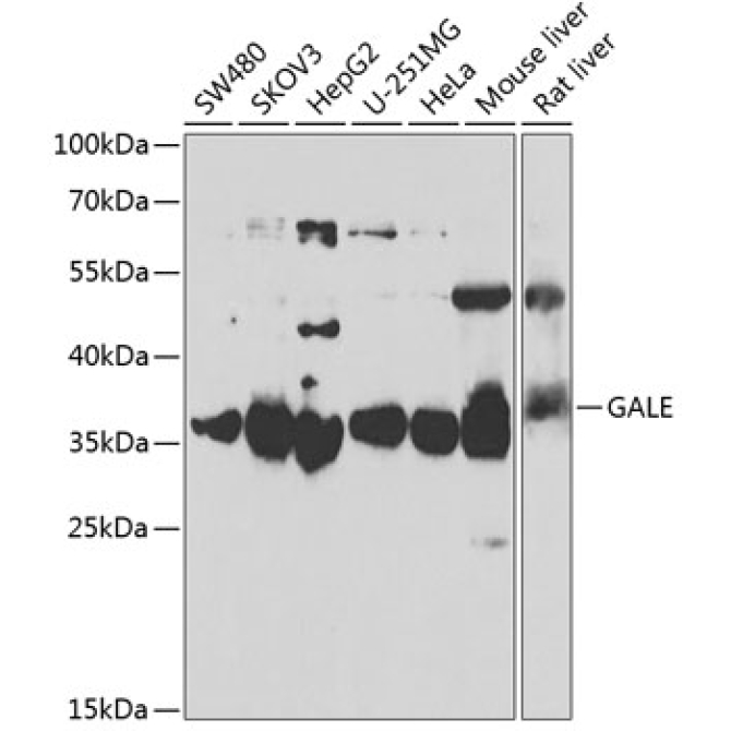 GALE Rabbit Polyclonal Antibody