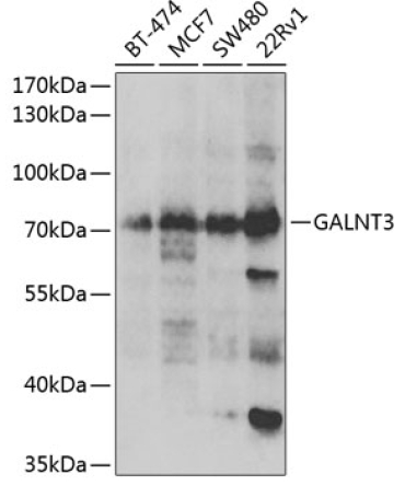 GALNT3 Rabbit Polyclonal Antibody