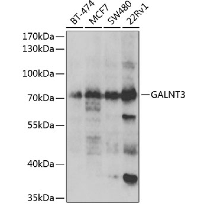 GALNT3 Rabbit Polyclonal Antibody