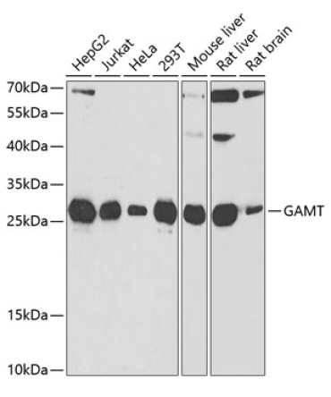 GAMT Rabbit Polyclonal Antibody