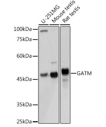 GATM Rabbit Polyclonal Antibody