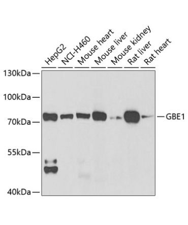 GBE1 Rabbit Polyclonal Antibody