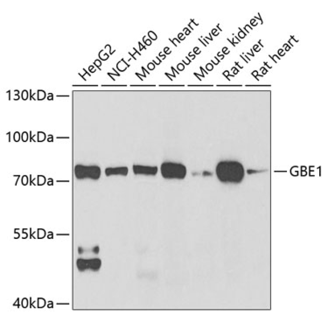 GBE1 Rabbit Polyclonal Antibody