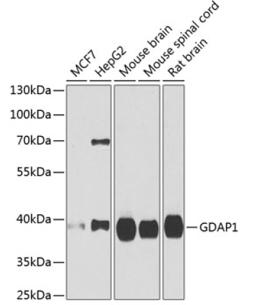 GDAP1 Rabbit Polyclonal Antibody
