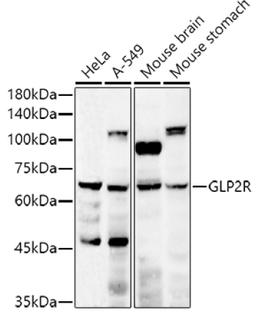 GLP2R Rabbit Polyclonal Antibody