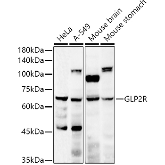 GLP2R Rabbit Polyclonal Antibody