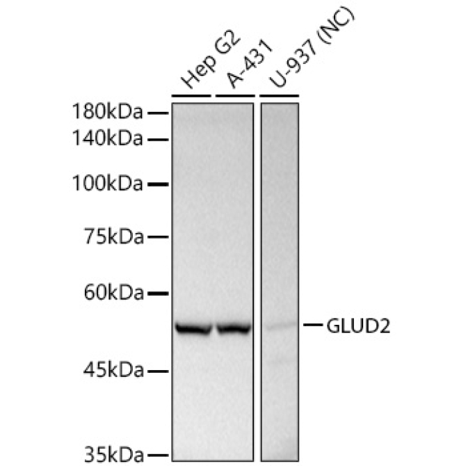GLUD2 Rabbit Polyclonal Antibody