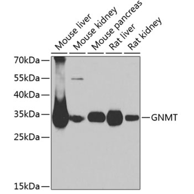 GNMT Rabbit Polyclonal Antibody