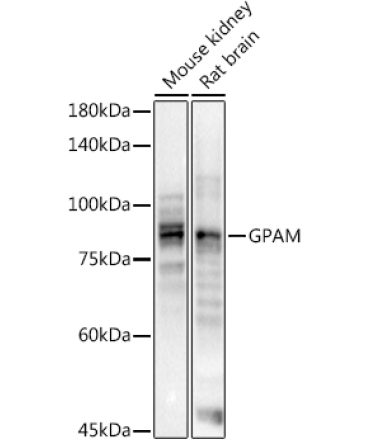 GPAM Rabbit Polyclonal Antibody