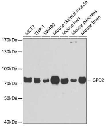 GPD2 Rabbit Polyclonal Antibody