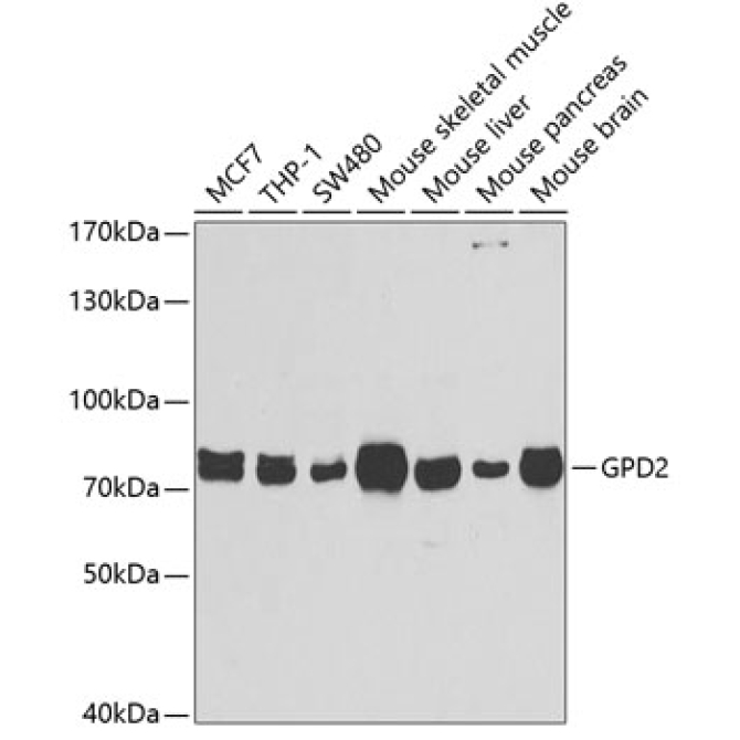 GPD2 Rabbit Polyclonal Antibody
