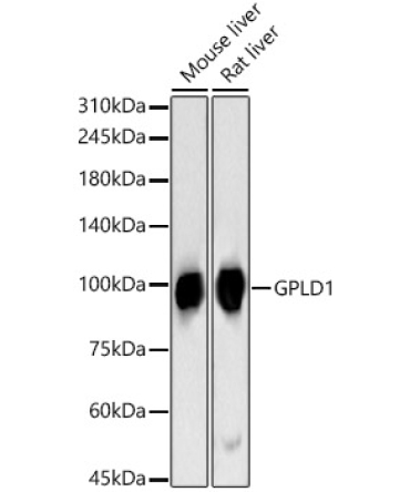 GPLD1 Rabbit Polyclonal Antibody