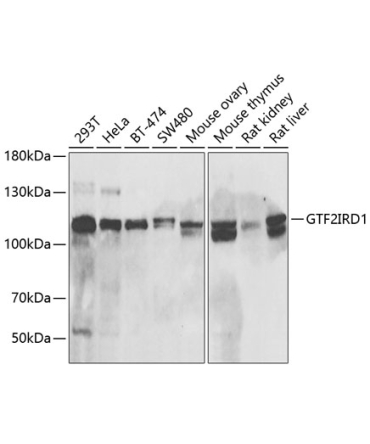 GTF2IRD1 Rabbit Polyclonal Antibody