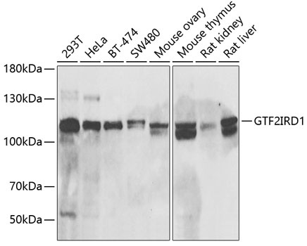 GTF2IRD1 Rabbit Polyclonal Antibody
