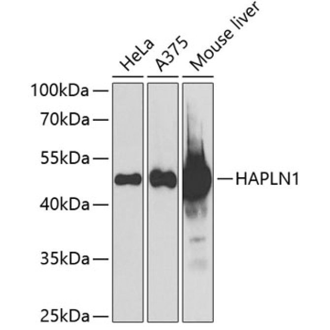 HAPLN1 Rabbit Polyclonal Antibody