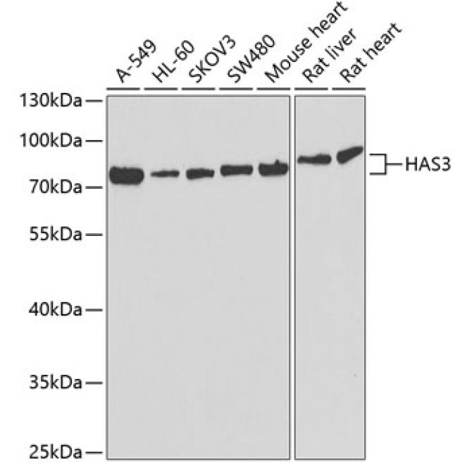 HAS3 Rabbit Polyclonal Antibody