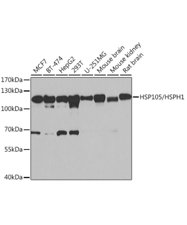 HSP105/HSPH1 Rabbit Polyclonal Antibody