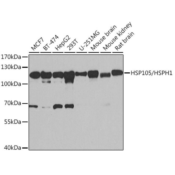 HSP105/HSPH1 Rabbit Polyclonal Antibody
