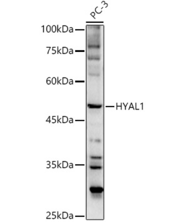 HYAL1 Rabbit Polyclonal Antibody