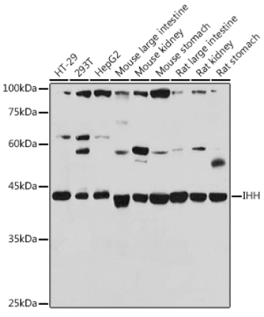 IHH Rabbit Polyclonal Antibody