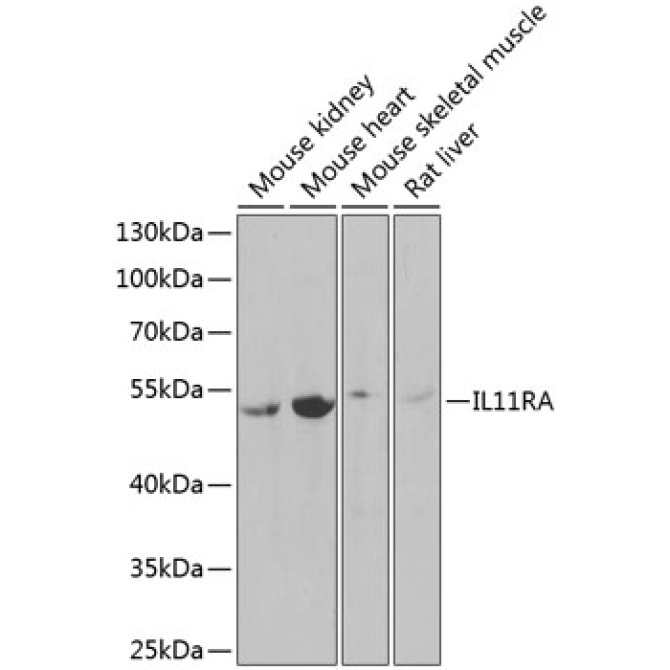 IL11RA Rabbit Polyclonal Antibody
