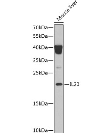IL20 Rabbit Polyclonal Antibody