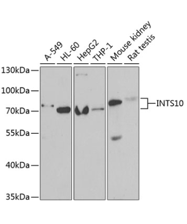 INTS10 Rabbit Polyclonal Antibody