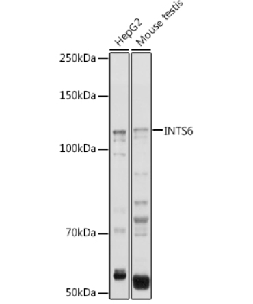 INTS6 Rabbit Polyclonal Antibody