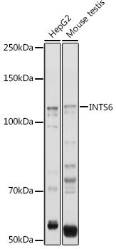 INTS6 Rabbit Polyclonal Antibody
