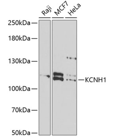 KCNH1 Rabbit Polyclonal Antibody